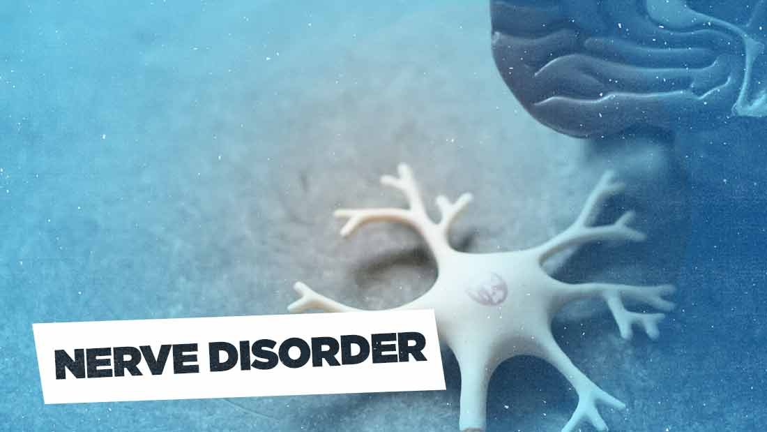 nerve-disorder